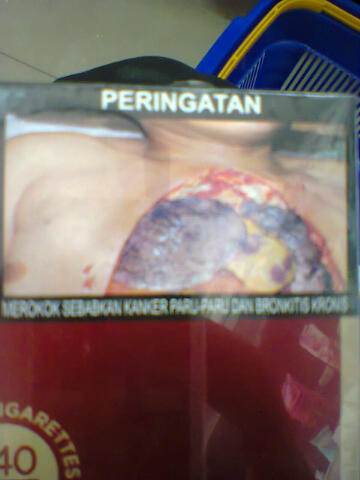 merokok sebabkan kanker paru-paru dan bronkitis kronis